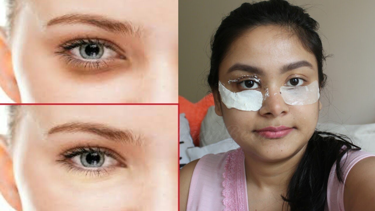 eye patches to get rid of dark circles