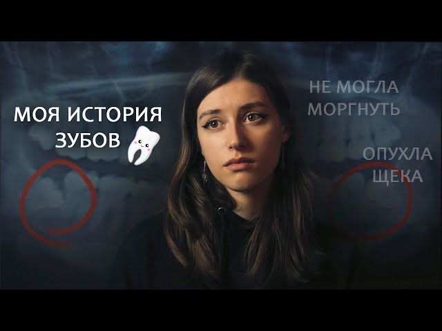 Как не бояться стоматолога 🦷 Лечение и Удаление