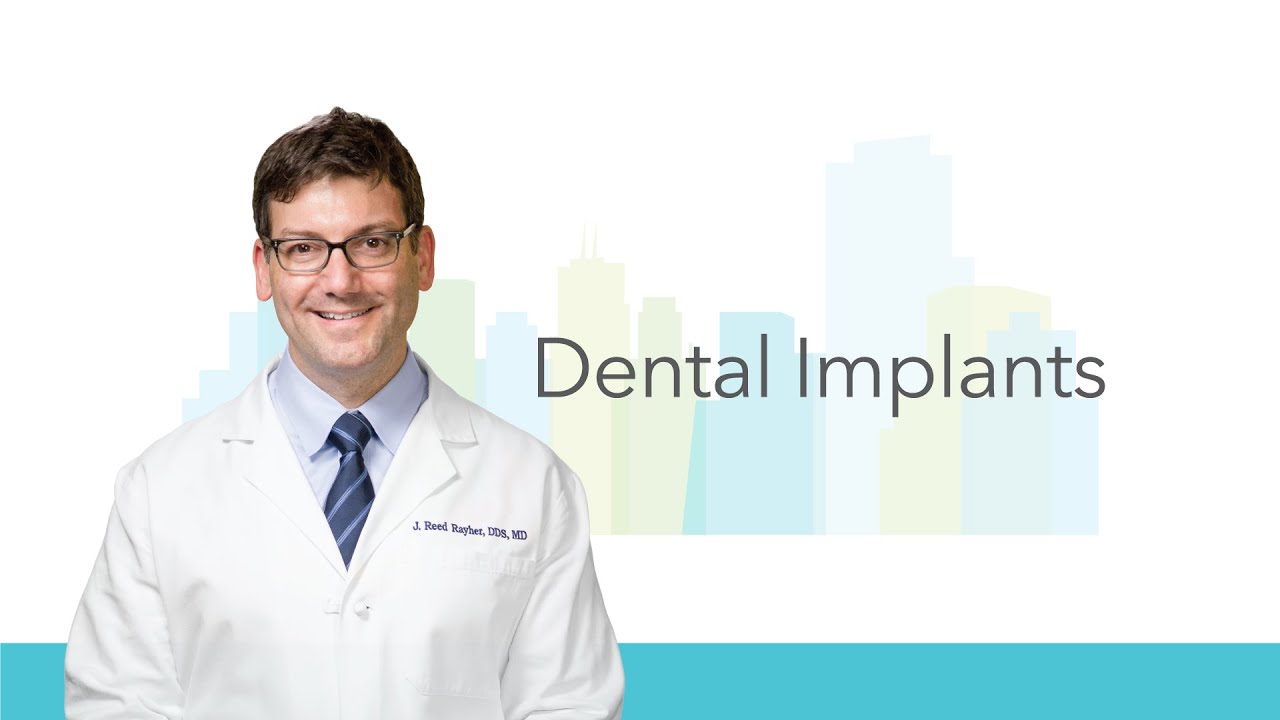 Dental Implants Information in San Francisco CA | Union Square Oral Surgery