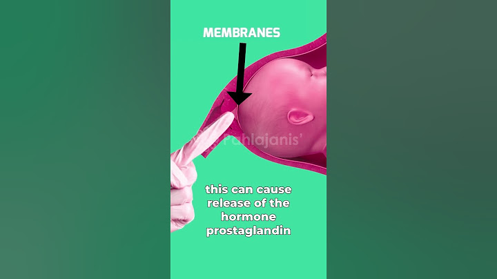 What is Membrane Sweep? 🤔 Is it safe⁉️ #pregnancy #labor #birth