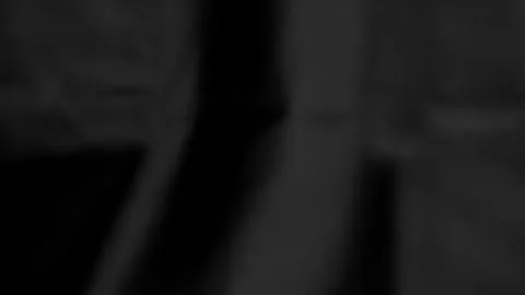 Q&A What is Charcot Foot Deformity