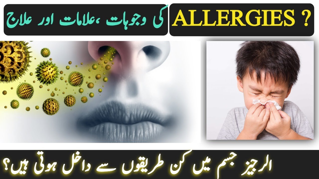 Allergies Symptoms Treatment Allergy Ka Ilaj Allergy Ki Alamat