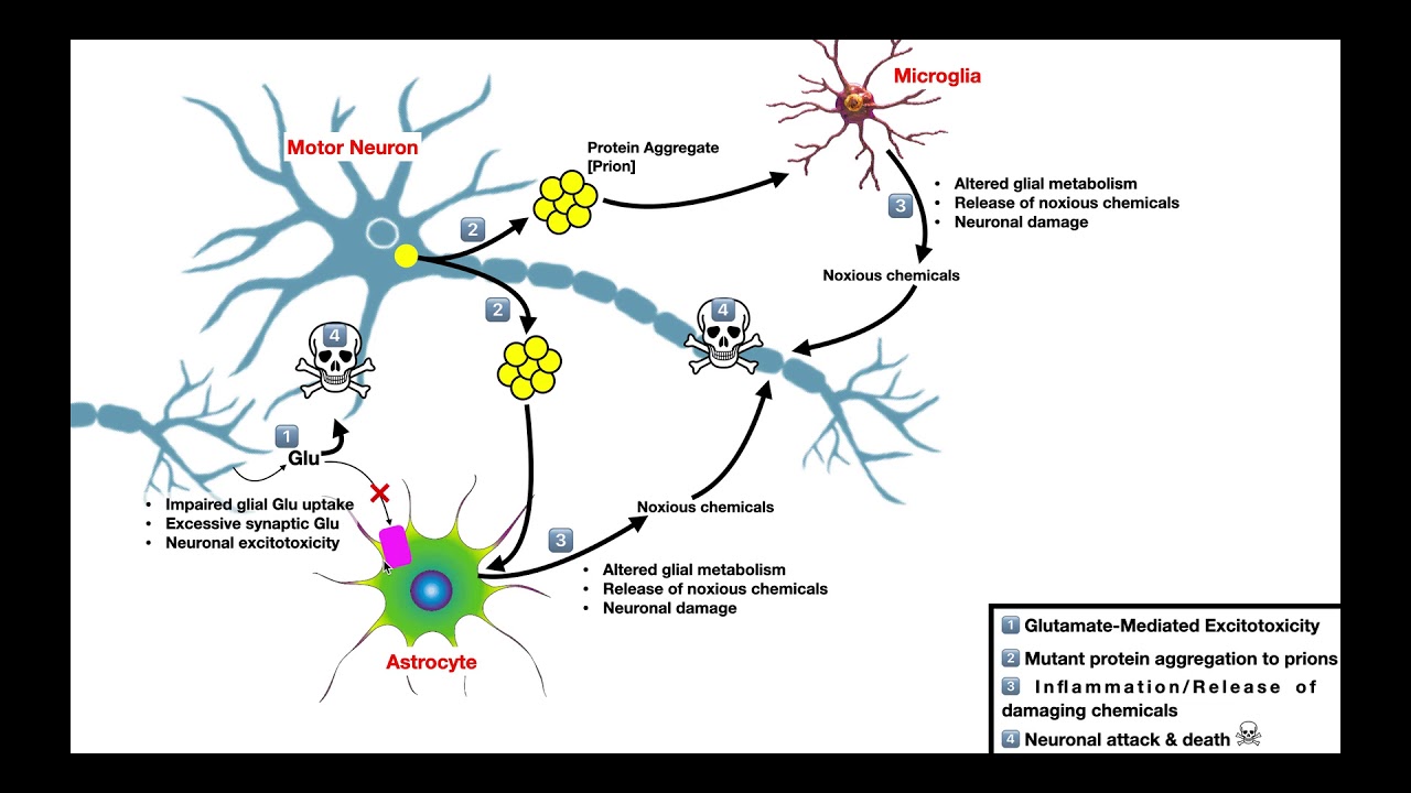 Amyotrophic Lateral Sclerosis [ALS] | Mechanism of Neuron Death