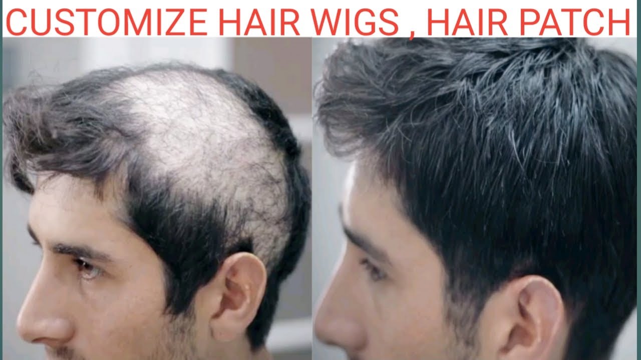 Hair Wigs Shop In Delhi Customize Human Hair Wigs Manufacturer In India Customize Hair Patch