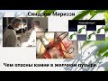 Синдром Мириззи. Чем опасны камни в желчном пузыре.