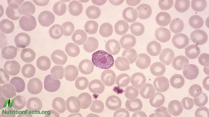 What Does a Low White Blood Cell Count Mean? - DayDayNews