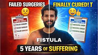 5 Years Of Suffering 3 Failed Surgeries Finally Cured Of Complex Fistula Patient From Kerala
