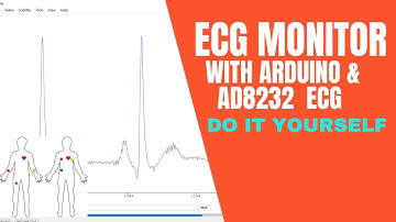 ARDUINO ECG MONITOR/ ഇത്രയും സിംപിളാണ്