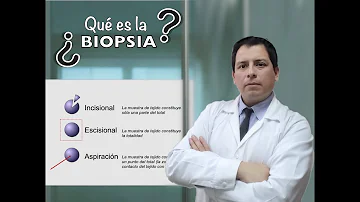 ¿Qué prueba una biopsia?