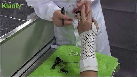 Extensor Tendon Dynamic Splint English Dubbing 2017