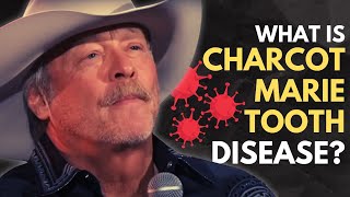 How Will Alan Jackson's Disease Impact His Life? Explaining Charcot-Marie-Tooth Disease