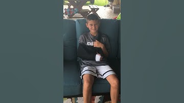My friends broken arm