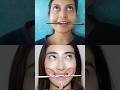 Just 1 Exercise to Reduce Smile Lines, Sagging...