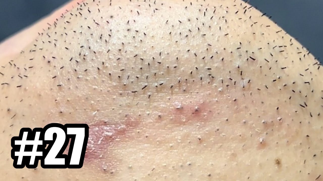 pull-out-hair-beard-removeal-plucking-facial-hair-27