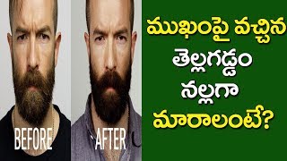 Natural Remedies to Make White Beard Black In Telugu | Beauty Tips Telugu | Star Telugu YVC |