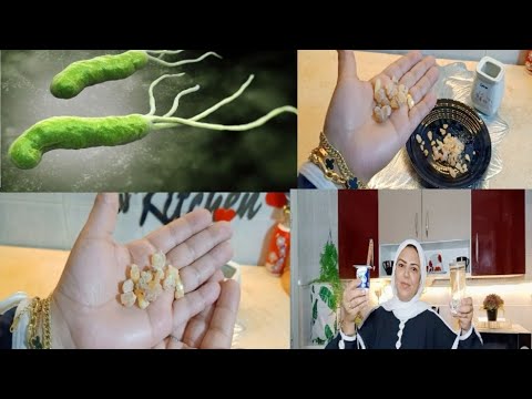 تعالو اقولكم بعمل إيه لما بتعرض للمرض ده روتين الشفاء من جرثومة المعدة فوائد لبان الذكر المذهله