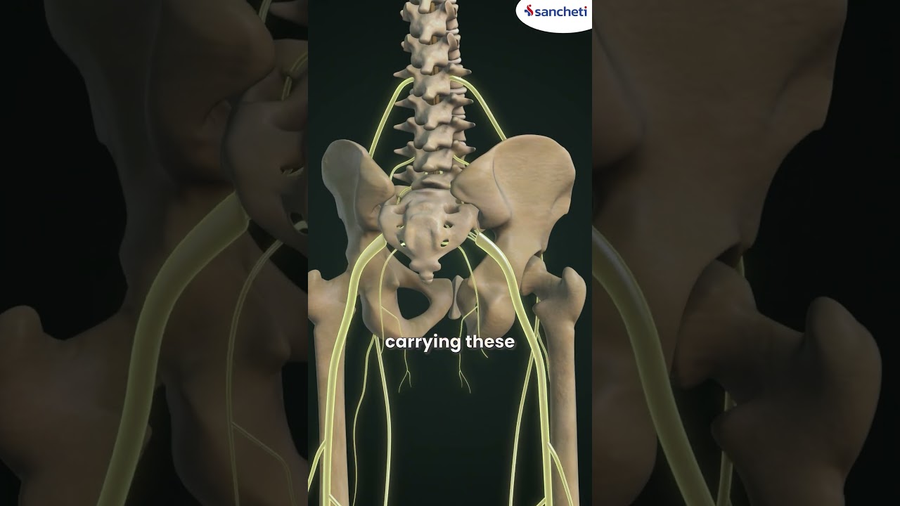 What Is a Slip Disc? Causes, Symptoms & Treatment | Dr. Pramod Bhilare | Sancheti Hospital