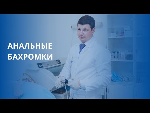 Анальные бахромки