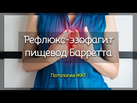 Рефлюкс эзофагит и пищевод Барретта | Патология