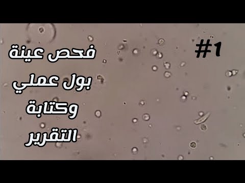 فيديو: كيفية حساب نسبة الكوليسترول: 11 خطوة (بالصور)