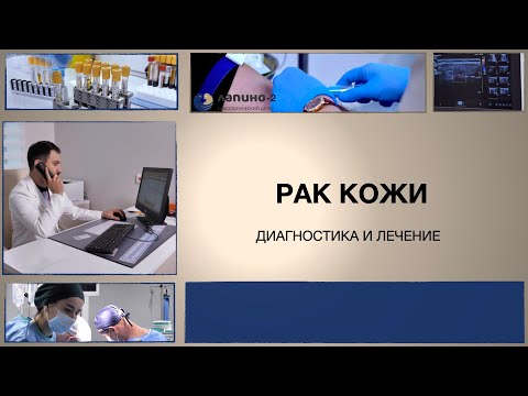 Симптомы и диагностика рака кожи.