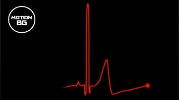 Heart Beat Pulse | ECG Monitor | Free Animation Background