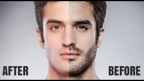 REMOVE PERMANENTLY UNWANTED FACIAL, EAR HAIRS  @DrJAYANTBATRA