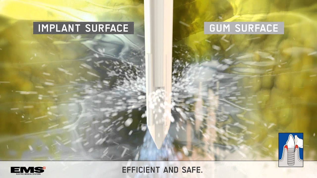 AF Powder PERIO animation AIRFLOW Kills Biofilm YouTube