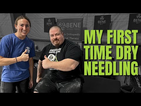 Dry Needling For Bench Press Forearm Pain