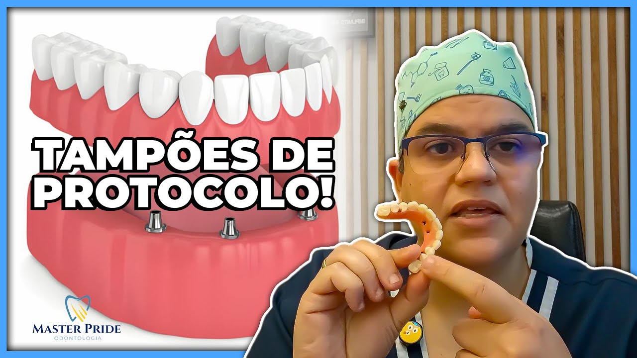 Tampão de implante: O que usar para vedar os acessos?| Master Pride Odontologia | Dra Bianca Rosa