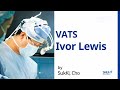 Ivor lewis vatsassisted thoracoscopic surgery