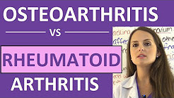Osteoarthritis vs Rheumatoid Arthritis Nursing | Symptoms, Pathophysiology, Treatment Mnemonic NCLEX