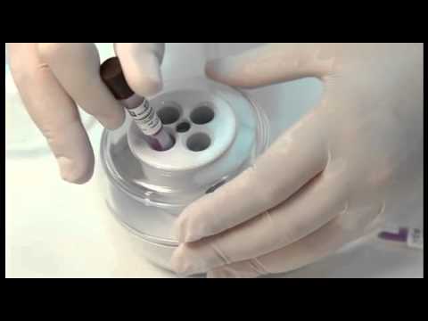 Vídeo: Quais são os indicadores biológicos para esterilização?