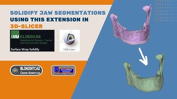 Solidify Jaw Segmentations in 3D Slicer using this extension