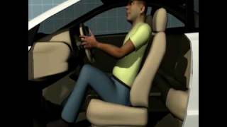 High Impact Rear-End Collision neck injury courtroom presentation