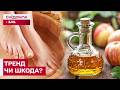 Оцтові ванночки: чи справді працюють? Пояснює експерт