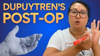 3 Things Every Therapist Should Address After Dupuytren's Release