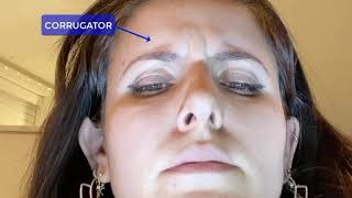 Corrugator vs. Procerus