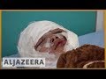 🇾🇪 Yemen war: Sanaa air raids victims slam Saudi-UAE coalition | Al Jazeera English