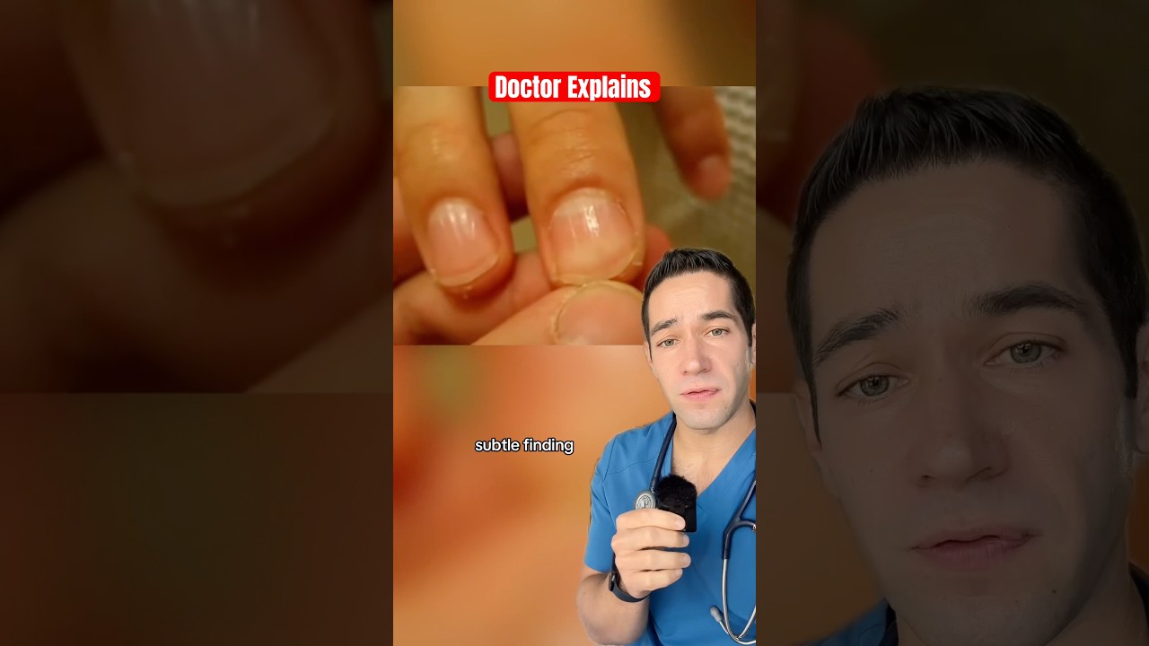 Why this is a BAD sign 😳