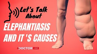 Apa itu Elephantiasis dan Penyebabnya | Diskusi Medis Langsung Dokter