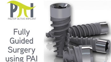 Paltop Fully Guided Surgery using a PAI implant