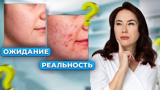 Почему нет результатов? Главные ОШИБКИ в уходе за кожей лица!