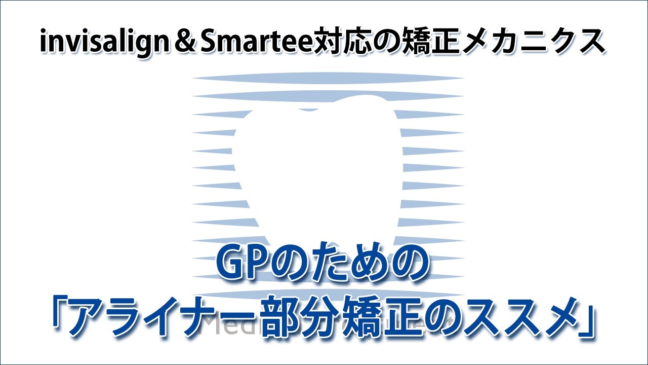 invisalign&Smartee対応の矯正メカニクス GPのためのアライナー部分