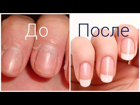 ✦ Как сделать чтобы кутикула не росла ЛАЙФХАК