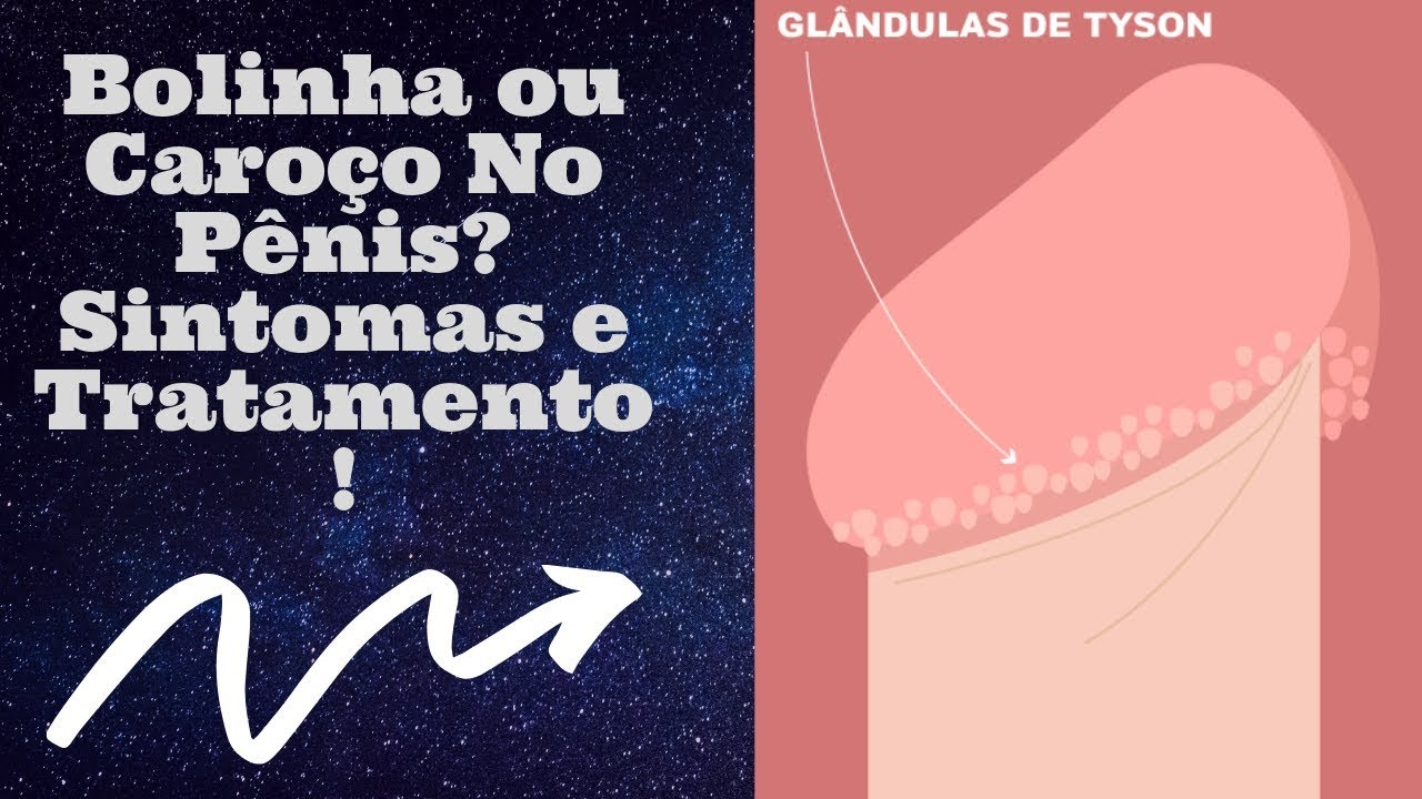 remedio natural para cisto sebaceo