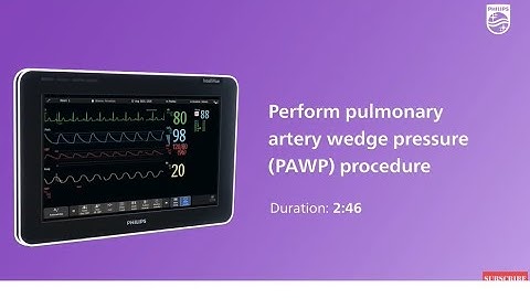 Perform a PAWP procedure with the IntelliVue patient monitor