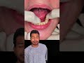 Preocupado porque vas a iniciar a hacer tus prótesis dentales