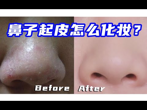 【婷婷护肤】鼻子起皮怎么化妆？你们肯定有过这样的疑惑…