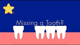 Tooth Replacement | ALFIE Dentistry